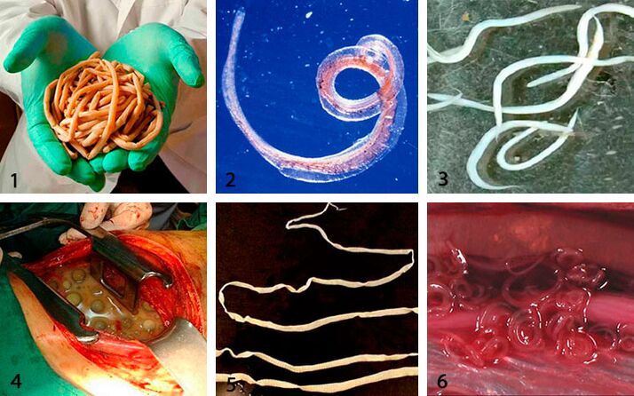 Types de parasites