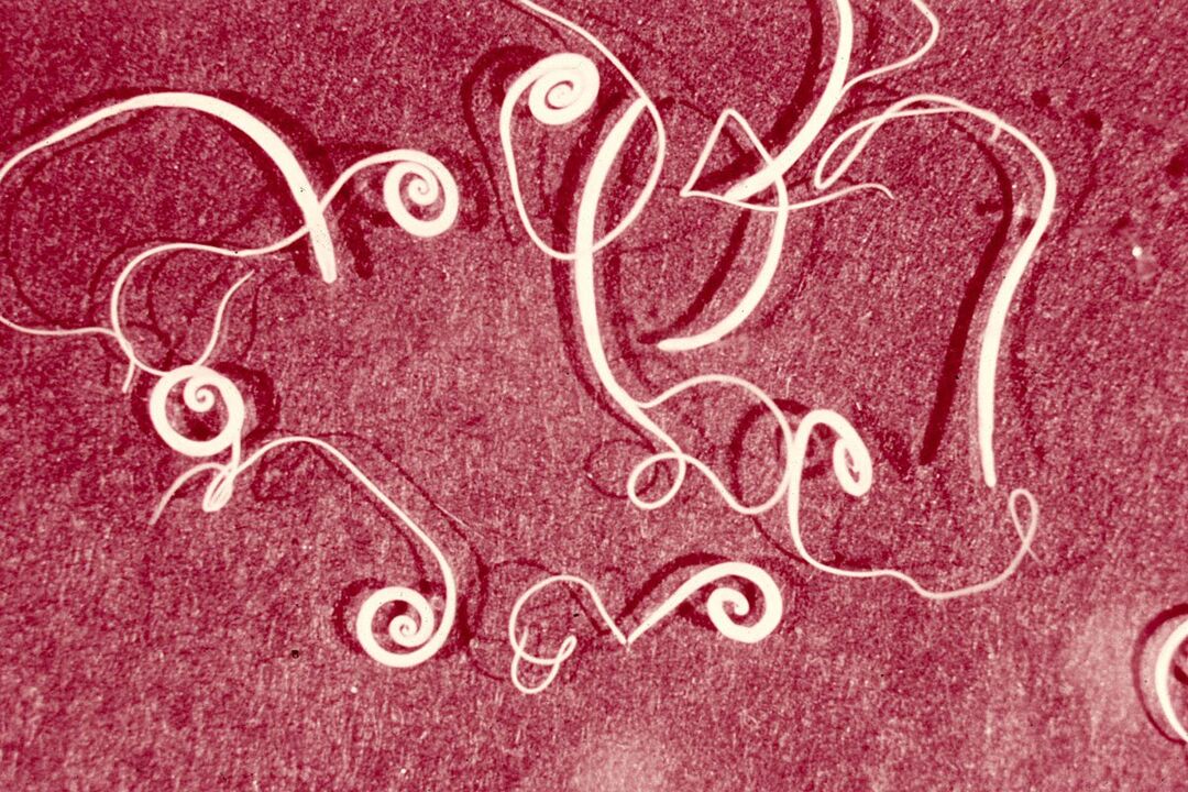 vers humains Trichinella